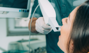 5 Myths About Our Teeth Whitening