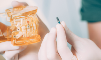 How Gum Disease Cause Heart Attacks